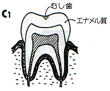 �b�P����