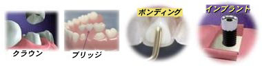 Alternatives to Braces