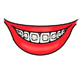 Braces (orthodontics)