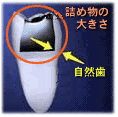 Size of filling and remaining tooth structure are considered