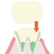 �N���E�����Âɂ���