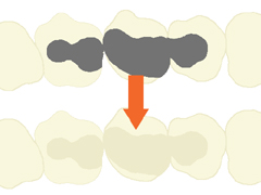 ���̐F�������l�ߕ�
